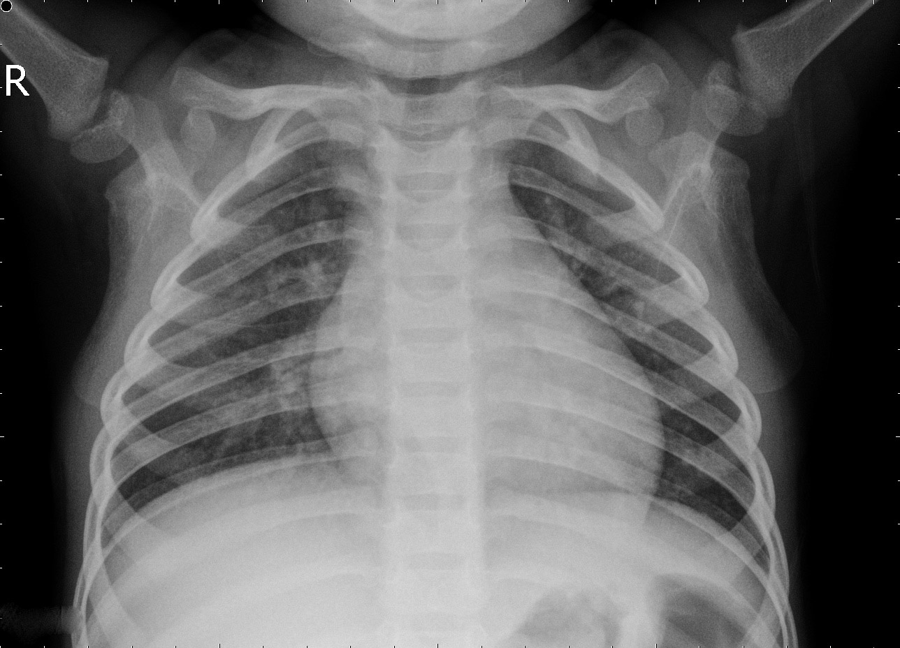 Normal X-ray Example 2